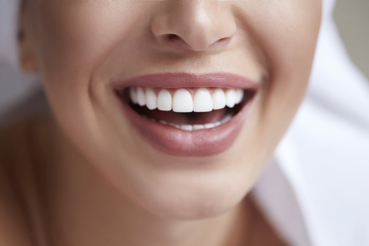 Teeth Whitening in Roseville, MN Personal Care dentistry dentist in roseville MN Dr. Walter Hunt DDS Dr. Kyle Hunt DDS Dr. Andrew Heinisch DDS